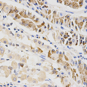 Immunohistochemistry of paraffin-embedded mouse spleen using β-TrCP/BTRC Rabbit pAb  at dilution of 1:100 