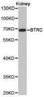 Western blot analysis of extracts of U-251MG cells, using β-TrCP/BTRC antibody  at 1:1000 dilution