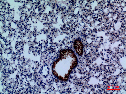 a01749 1 dpyd primary antibodies ihc testing 1
