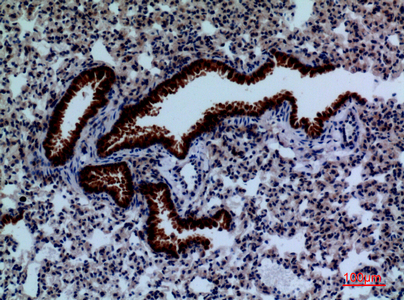 a01749 1 dpyd primary antibodies ihc testing 4