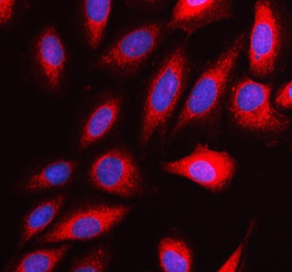 IF analysis of DPYD using anti-DPYD antibody (A01749)