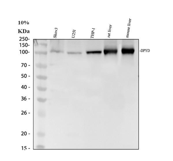 Western blot analysis of DPYD using anti-DPYD antibody (A01749)