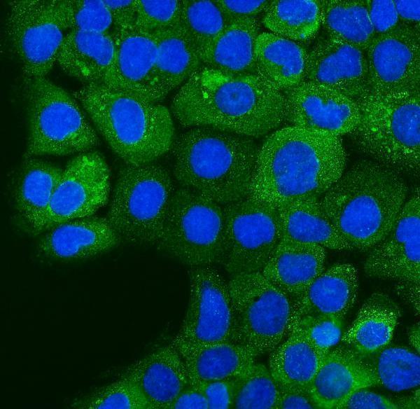 a01750 2 ezr primary antibodies if testing 6