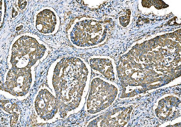  IHC analysis of Ezrin/EZR using anti-Ezrin/EZR antibody (A01750-2)