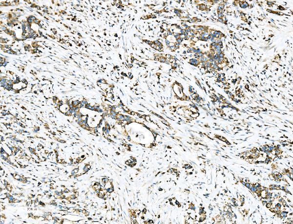  IHC analysis of Ezrin/EZR using anti-Ezrin/EZR antibody (A01750-2)