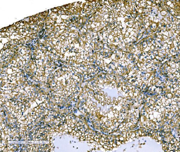 a01750 2 ezr primary antibodies ihc testing 4