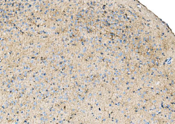 a01750 2 ezr primary antibodies ihc testing 5