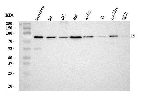  Western blot analysis of Ezrin/EZR using anti-Ezrin/EZR antibody (A01750-2)