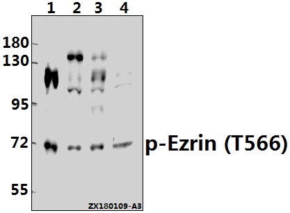 Western blot (WB) analysis of p-Ezrin (T566) pAb at 1:500 dilution
Lane1:HEK293T whole cell lysate(40ug)
Lane2:U-87MG whole cell lysate(40ug)
Lane3:A2780 whole cell lysate(40ug)
Lane4:SGC7901 whole cell lysate(40ug)