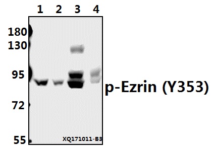 Western blot (WB) analysis of p-Ezrin (Y353) pAb at 1:500 dilution
Lane1:A549 whole cell lysate(40ug)
Lane2:HEK293T whole cell lysate(40ug)
Lane3:PMVEC whole cell lysate(40ug)
Lane4:3T3-L1 whole cell lysate(40ug)