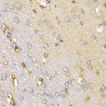 Immunohistochemistry of paraffin-embedded rat brain using SFRP2 antibody at dilution of 1:200 (400x lens)