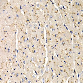 Immunohistochemistry of paraffin-embedded mouse heart using SFRP2 antibody at dilution of 1:200 (400x lens)