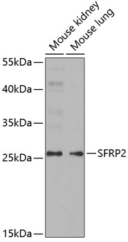 Western blot analysis of extracts of various cells, using SFRP2 antibody