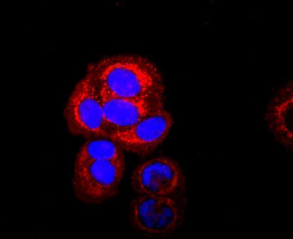 ICC staining SDHA in MCF-7 cells (red)