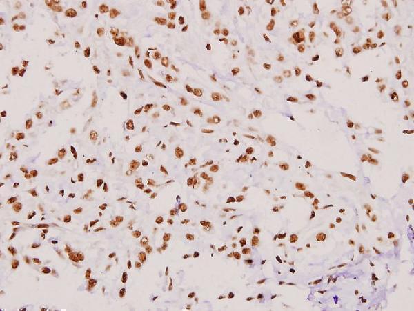 a01754 1 kif11 primary antiboties ihc testing 2