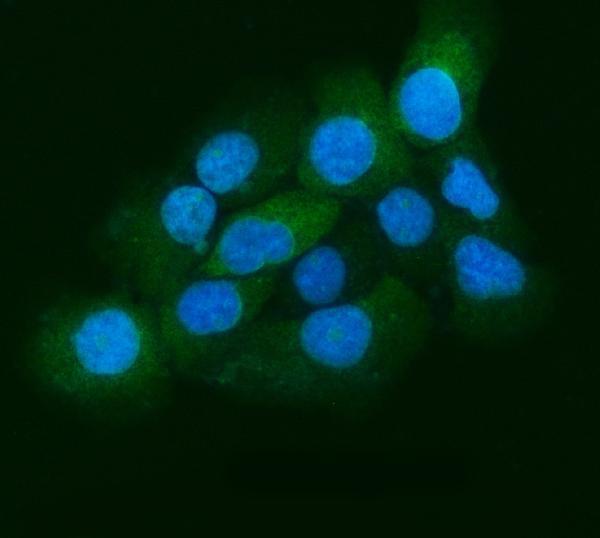a01754 2 kif11 primary antibodies if testing 5