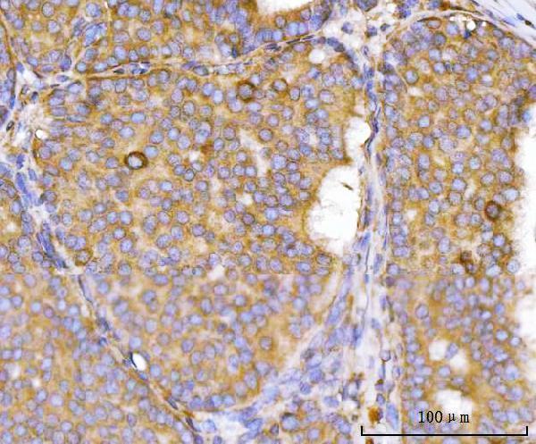  IHC analysis of Eg5/KIF11 using anti-Eg5/KIF11 antibody (A01754-2)