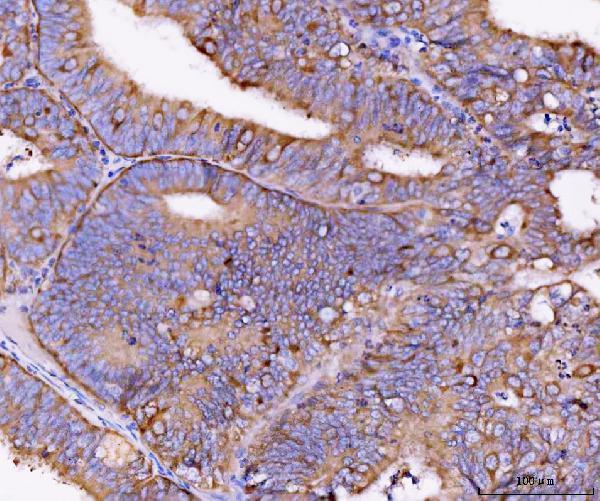  IHC analysis of Eg5/KIF11 using anti-Eg5/KIF11 antibody (A01754-2)