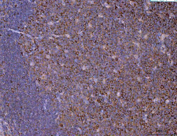 a01754 2 kif11 primary antibodies ihc testing 4