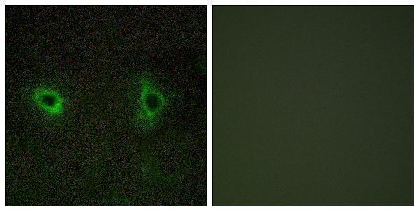 Immunofluorescence analysis of COS7 cells, using Collagen IV alpha3 Antibody