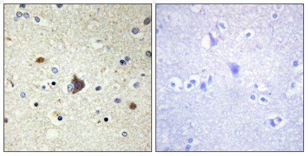 Immunohistochemistry analysis of paraffin-embedded human brain tissue, using Collagen IV alpha3 Antibody