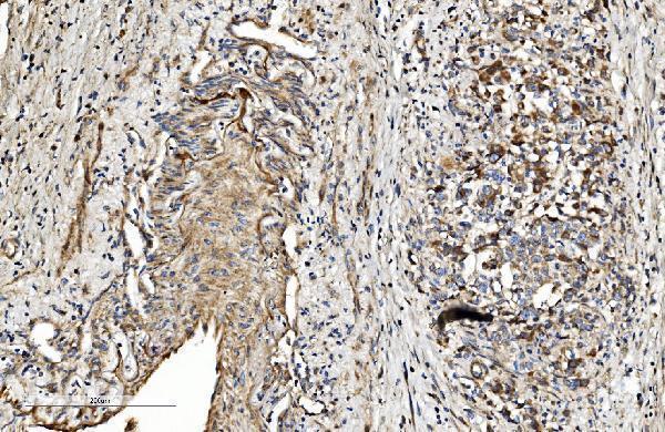  IHC analysis of COL4A3 using anti-COL4A3 antibody (A01755-3)