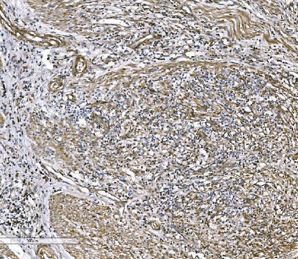  IHC analysis of COL4A3 using anti-COL4A3 antibody (A01755-3)