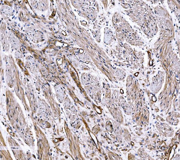  IHC analysis of COL4A3 using anti-COL4A3 antibody (A01755-3)