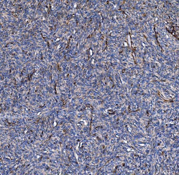 a01755 3 col4a3 primary antibodies ihc testing 4