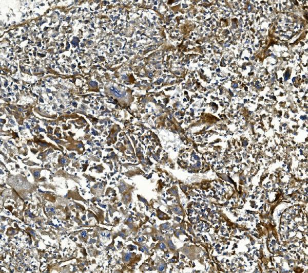 a01755 3 col4a3 primary antibodies ihc testing 5