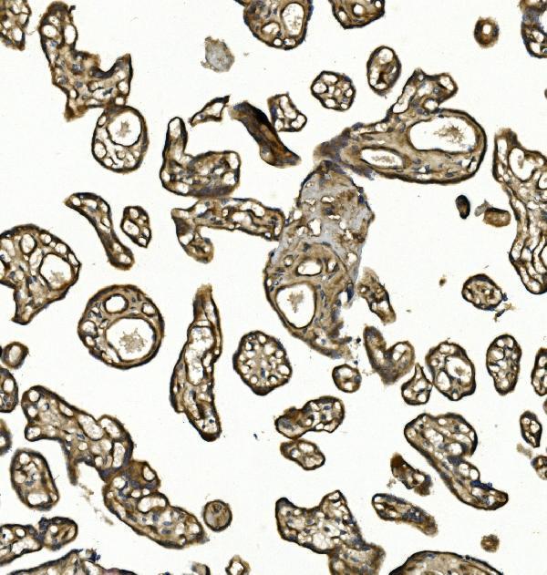 a01755 3 col4a3 primary antibodies ihc testing 6