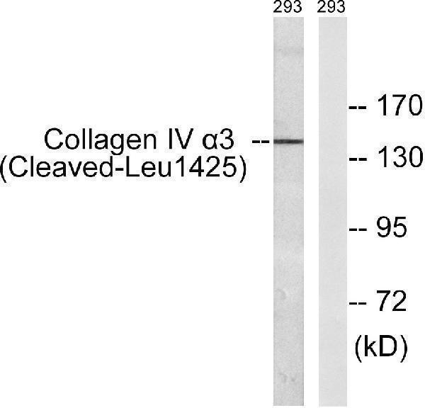 Western blot analysis of lysates from 293 cells, treated with etoposide 25uM 1h, using Collagen IV alpha3 (Cleaved-Leu1425) Antibody