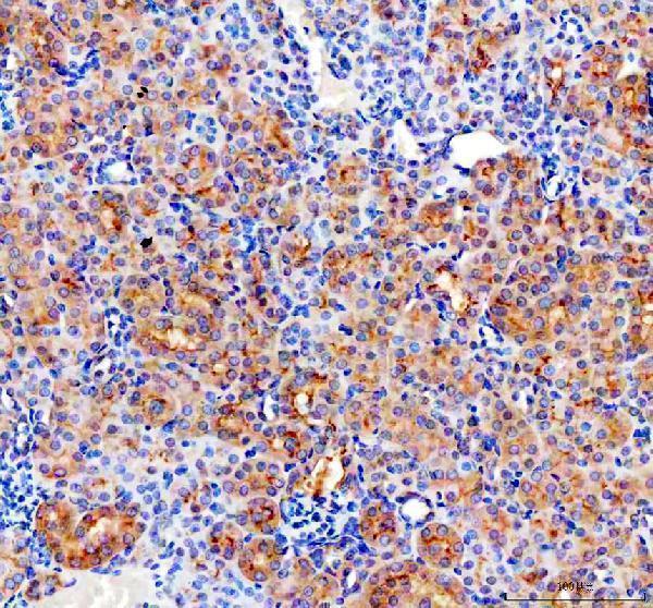 a01756 2 cd2ap primary antibodies ihc testing 2