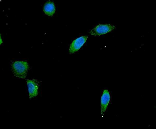 a01757 1 aes primary antibodies if testing 3