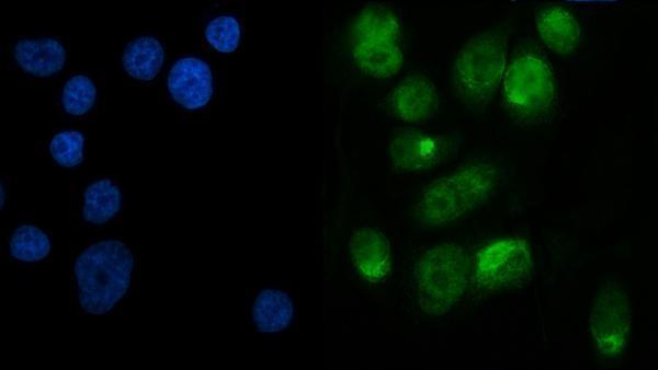 a01758 2 mettl3 primary antibody if testing 5