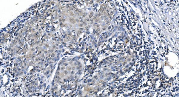 a01758 2 mettl3 primary antibody ihc testing 2