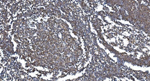 a01758 2 mettl3 primary antibody ihc testing 3