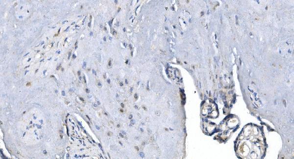 a01758 2 mettl3 primary antibody ihc testing 4