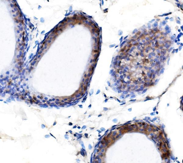 a01758 2 mettl3 primary antibody ihc testing 7