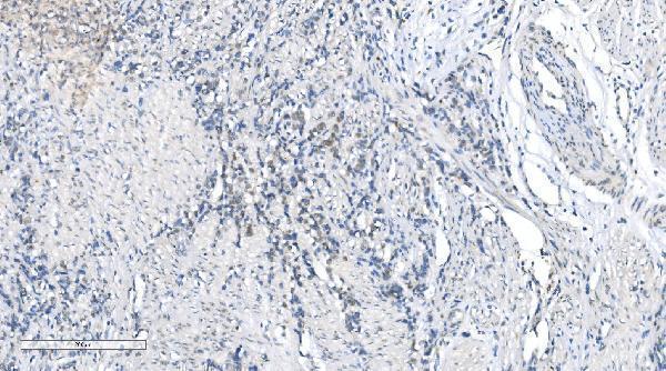a01758 3 mettl3 primary antibodies ihc testing 7