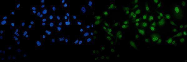 a01758 3 mettl3 primary antibody if testing 5
