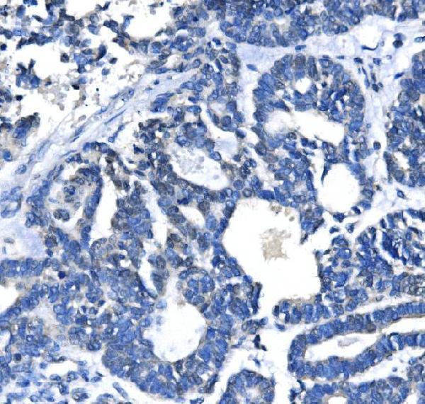  IHC analysis of METTL3 using anti-METTL3 antibody (A01758-3)