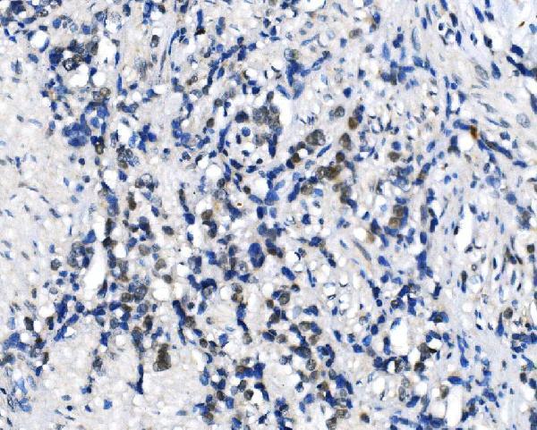  IHC analysis of METTL3 using anti-METTL3 antibody (A01758-3)