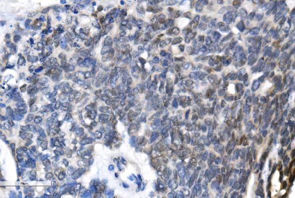 a01758 3 mettl3 primary antibody ihc testing 4