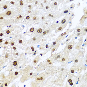 a01758 mettl3 primary antiboties ihc testing 2