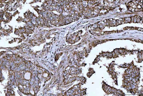 a01759 3 hbegf primary antibodies ihc testing 2