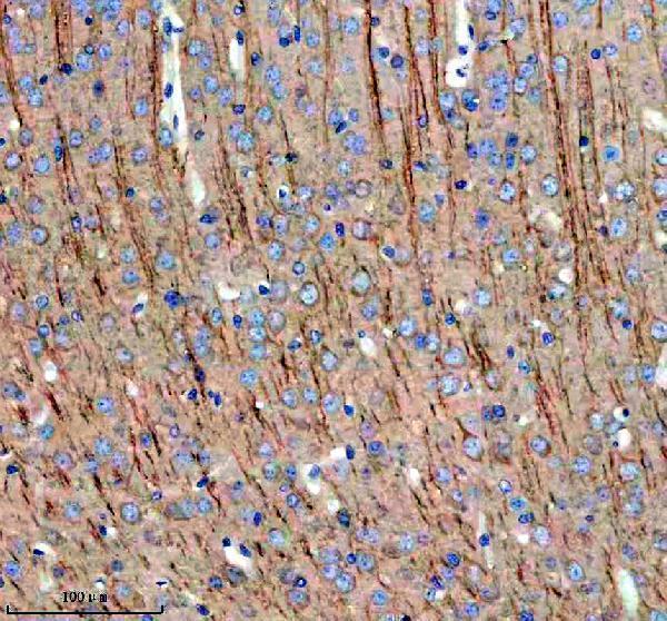  IHC analysis of MAP1B using anti-MAP1B antibody (A01760-1)