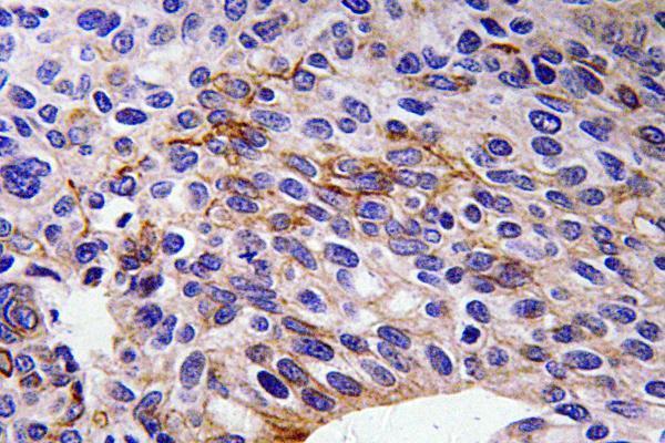 a01761 2 sema3a primary antibodies ihc testing 1