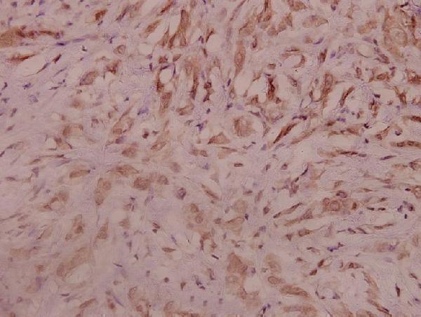 a01761 sema3a primary antiboties ihc testing 2