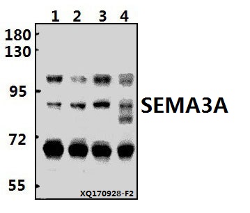 a01761 sema3a primary antiboties wb testing 1